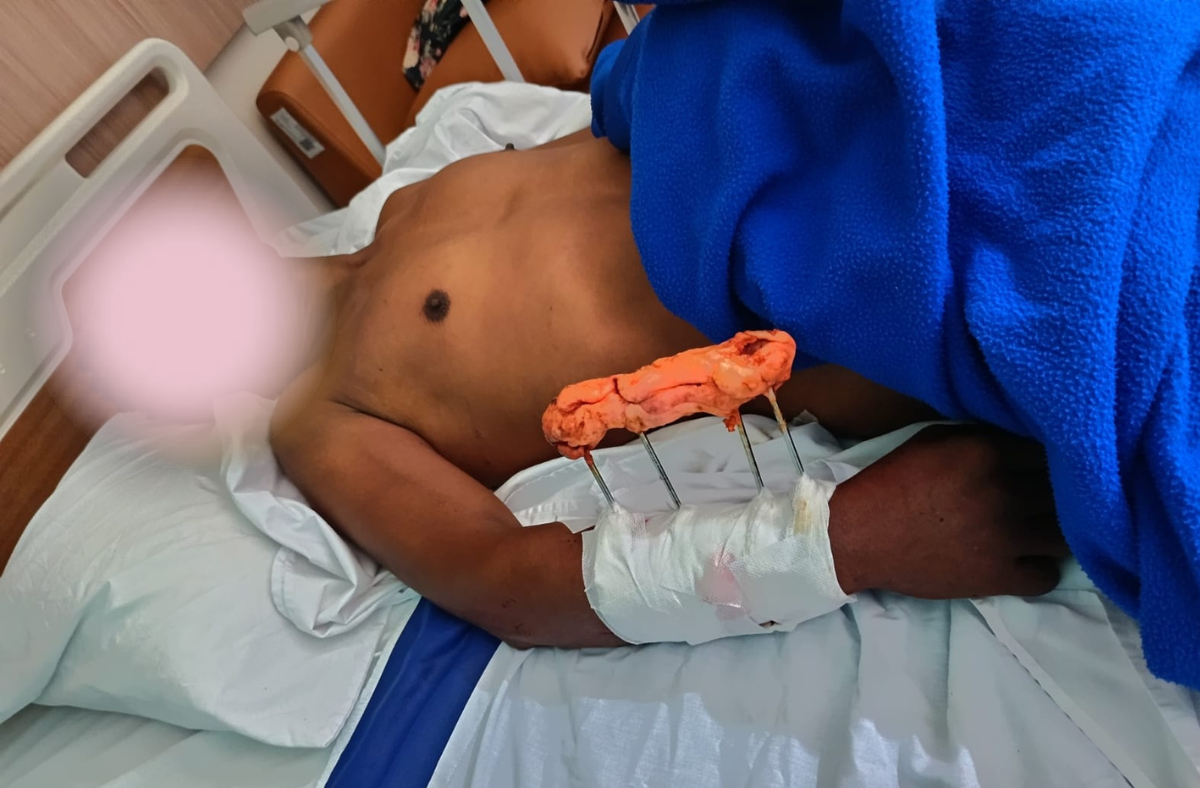 KONFLIK MANUSIA DAN BUAYA DI SUAKA MARGASATWA DANAU TUADALE: KORBAN BERTAMBAH, KEWASPADAAN MASYARAKAT DIPERKUAT